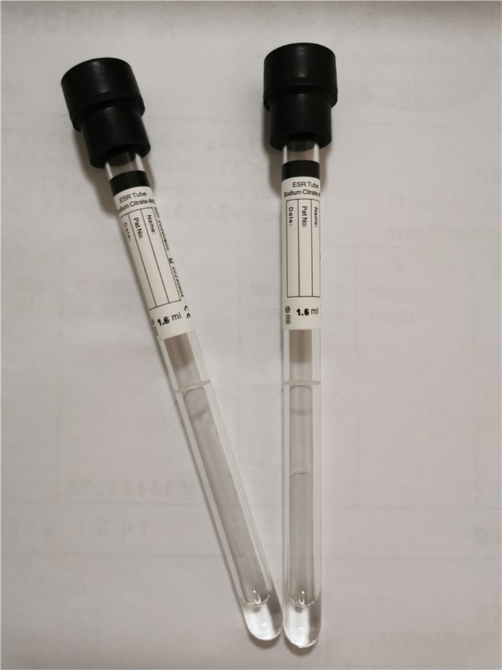 Sosium Citrate tube